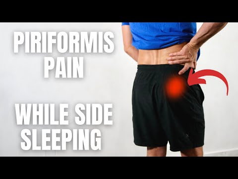 Sleeping On Side With Piriformis Syndrome Pain