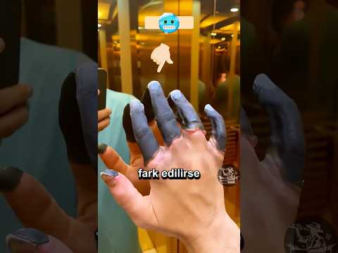 Dişsiz Ama Tehlikeli; Soğuk Isırması 🥶🦷
