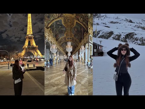Joanna se rompio un diente, pero en paris 😙