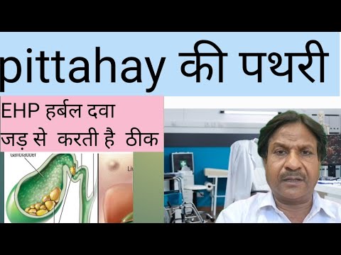 Gallbladder  ston विना ऑपरेशन ठीक करें