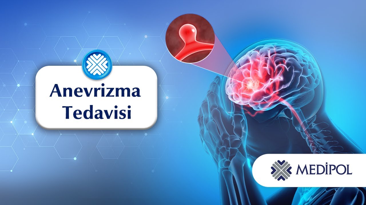 Beyin Anevrizması Nedir? Tedavisi Nelerdir?