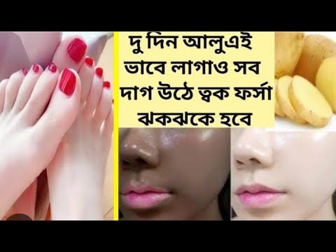 আলুর রস 2 দিন এইভাবে লাগাও সব কালো ময়লা তুলে ত্বক ফর্সা উজ্জ্বল হবে| alu diye forsa hobar upay