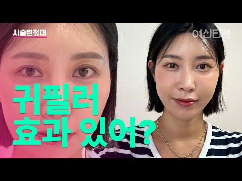 👂귀필러 진짜 어떻게 되는지 궁금하죠?👂