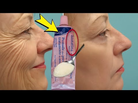 Use NISTATINA á noite - Eu Tinha RUGA FUNDA, RUGA NA BOCA e BOCHECHA CAIDA.