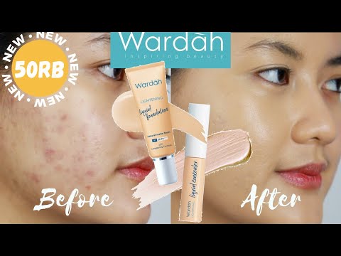 MURAH & BAGUS? - REVIEW TERLENGKAP WARDAH LIGHTENING FOUNDATION & CONCEALER DI ACNE PRONE SKIN