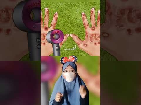 kumpulan Asmr luka infeksi 1(Telinga, kaki, badan, mulut) |Mv #shorts