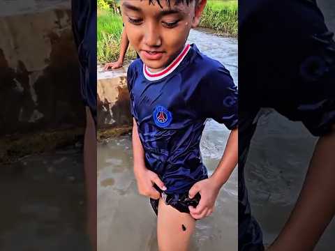 😱 ছেলেটার পায়ে এটা কি? #shorts