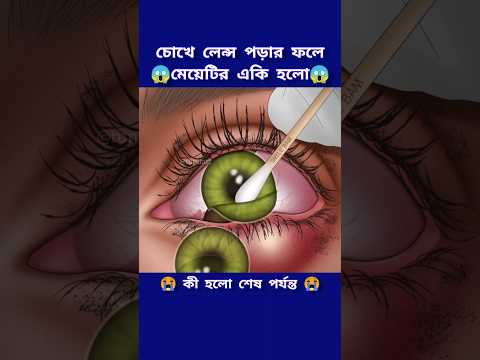 চোখে লেন্স ঢুকে মেয়েটির একি হলো #cartoon #3danimation