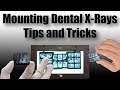 Dental Radiography Concepts and Techniques