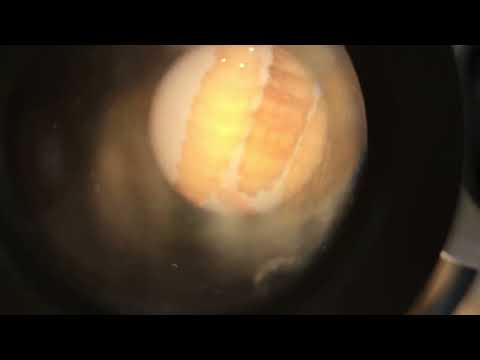YouTube video thumbnail: US Cattle Restrictions Over Screwworm Threatens Belize’s Export Industry