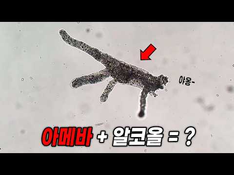 살아있는 아메바의 움직임은 충격적입니다 ㄷㄷ