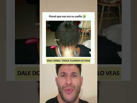Pensé que eso era su cuello.