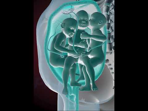 PRECIOUS MOMENTS OF TRIPLETS INSIDE THE WOMB  (3D ANIMATION)