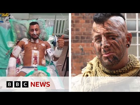 British soldier returns to Ukraine after life-changing injury - BBC News