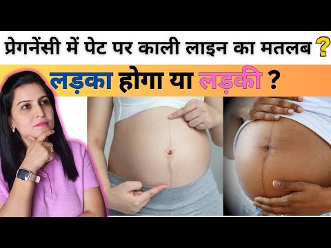 प्रेगनेंसी में पेट पर काली लाइन का मतलब लड़का होगा या लड़की | My Pregnancy Care