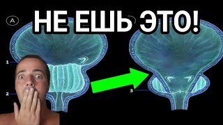 Самые вредные продукты для мочевого пузыря и простаты!