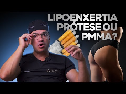 LIPOENXERTIA DE GLÚTEO, PRÓTESE OU PMMA? QUEM GANHA?