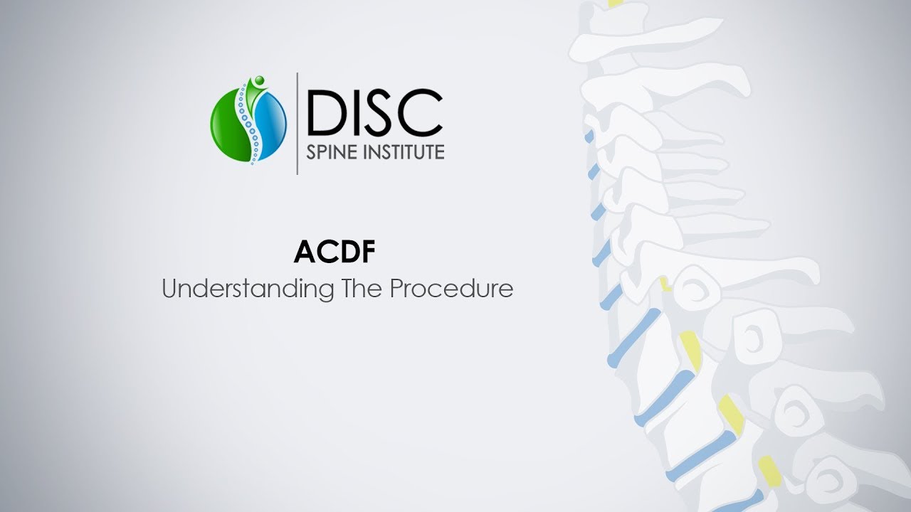 Anterior Cervical Discectomy and Fusion