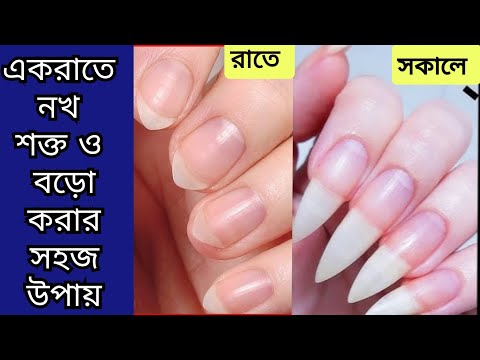 এক রাতে নখ শক্ত বড় করার সহজ উপায় /নখ সাদা ও পরিষ্কার করার উপায় / how to grow strong nail fast