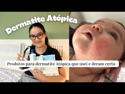 TODOS OS PRODUTOS PARA DERMATITE ATÓPICA QUE JÁ USEI - dermatite controlada