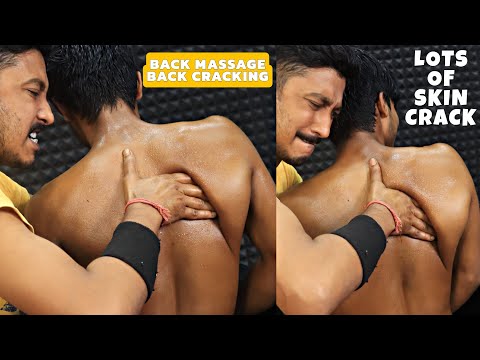 Amazing Back Massage & Tail Bone Cracking | Lots of Skin Cracking | Head & Scalp Massage | ASMR