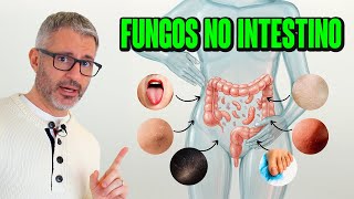 SIFO: sintomas e tratamentos para fungos no intestino