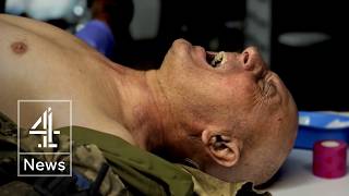 YouTube video thumbnail: The Shocking Reality of Ukraine's Drone War in an Underground Hospital