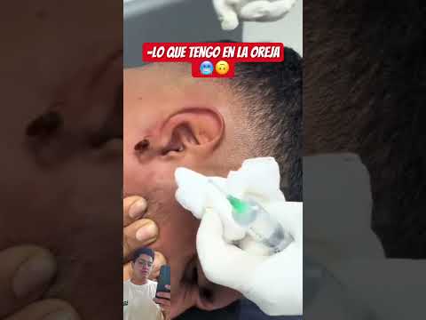 Yo me corto la oreja mejor 🥶😂😂 #humor #viral #fyp #parati #funny #shorts #reaction #oreja #animal