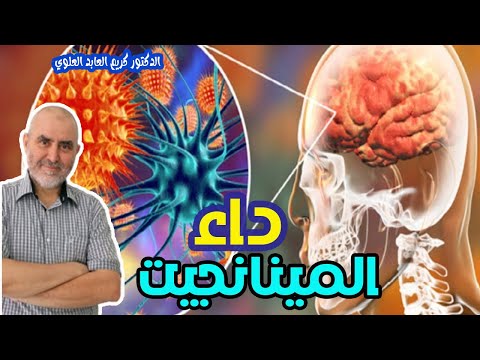 الحمى الشوكية أو المينانجيت   -   الدكتور كريم العابد العلوي   -