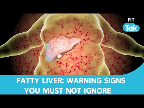 Fatty Liver: Warning Signs You Shouldn’t Ignore & How to Keep Your Liver Healthy | Health 360