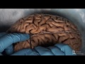 Brain Anatomy and Sulcus Relationships