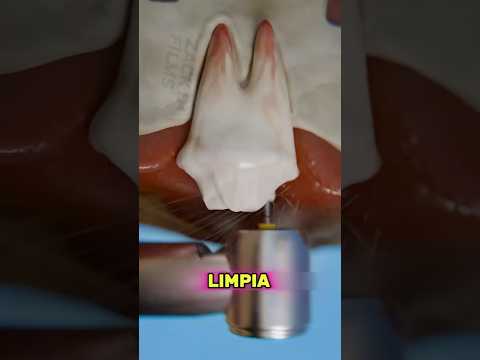 Le Trataron El Diente Roto Al Perro😨