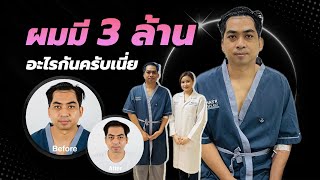 รีวิว ปลูกผมถาวรแบบหมดเปลือก แน่น ถี่ ละเอียด ทุกขั้นตอน ที่ 3M Hair Transplant โรงพยาบาลมาสเตอร์พีช
