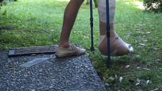 dislocated ankle and full leg cast: walking on grass