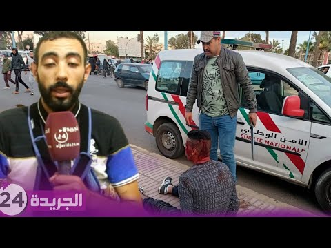 خطير .. عنصر دعم سابق بالأمن الوطني يتعرض لاعتداء تسبب في قطع 4 عصبات او العظم اليد اليمنى بالبيضاء
