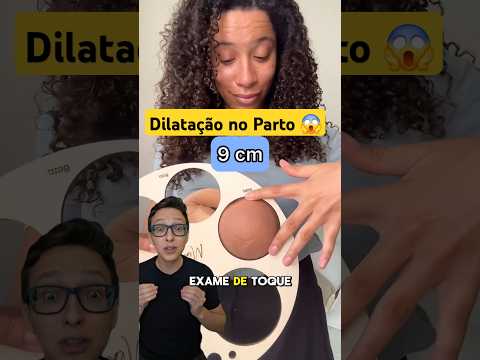 Dilatação no Parto 😱 #medicina #medico #enfermagem #enfermeiro #enfermeira Colo do Útero