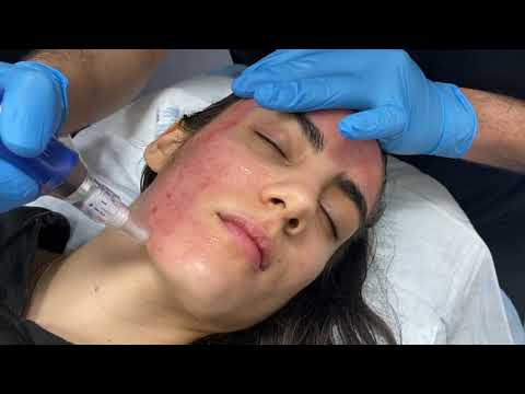 Facial treatment with hands and gloves involved.