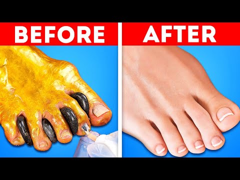 Time for At-Home Foot Therapy Hacks! 🦶 Natural & Affordable Tips for Healthy, Happy Feet