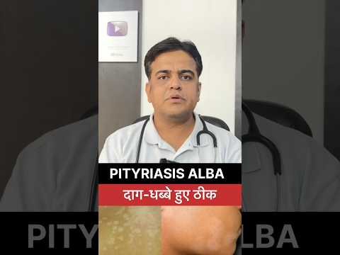 Pityriasis alba हुआ ठीक मिला दाग धब्बो से छुटकारा । Pityriasis alba permanent treatment#shorts ।