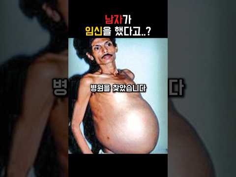 남자가 임신을..?