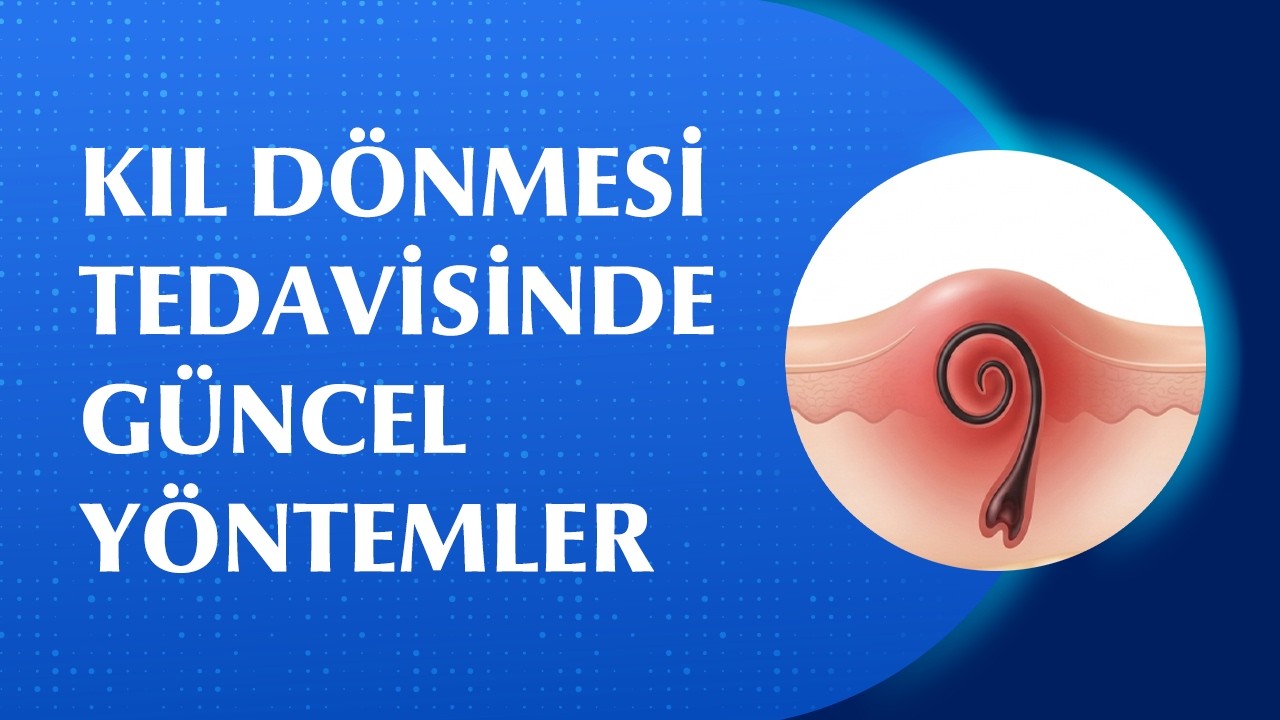 Kıl Dönmesi Belirtileri Nelerdir? Nasıl Tedavi Edilir?