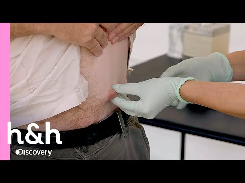 Caroço acaba "explodindo" antes de ser examinado | Dra. Sandra Lee: A Rainha dos Cravos | H&H Brasil