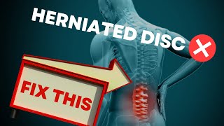 How to Fix a herniated disc in your lower back - FAST PAIN RELIEF