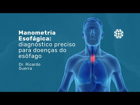 Manometria Esofágica: o que é e como pode ajudar você | Dr. Ricardo Guerra