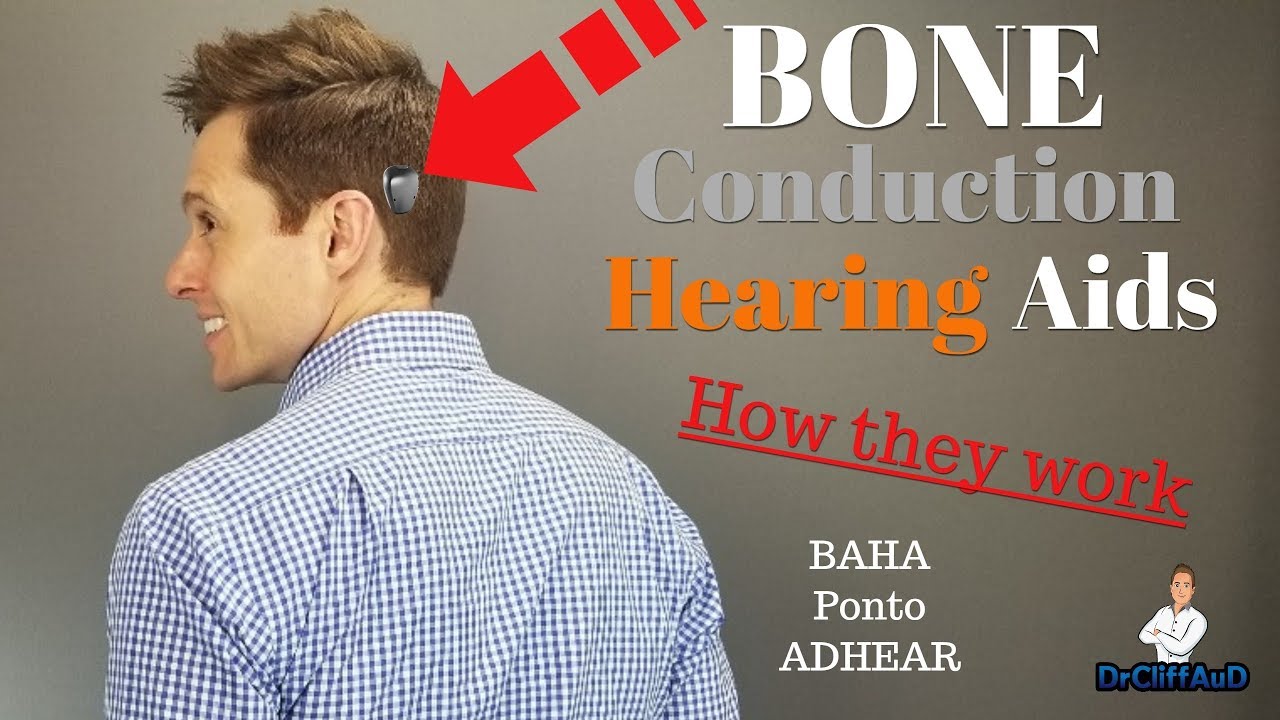 Cómo funcionan los audífonos de conducción ósea | Cochlear BAHA, Oticon Medical Ponto, Medel ADHEAR