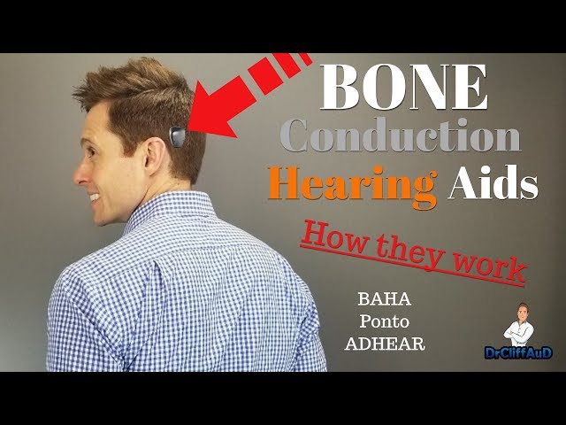 How Bone Conduction Hearing Aids Work | Cochlear BAHA, Oticon Medical Ponto, Medel ADHEAR