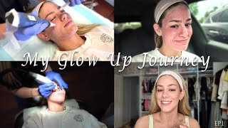 GLOW UP SERIES | Road To The Wedding: I get Microneedling done! | Ep. 1
