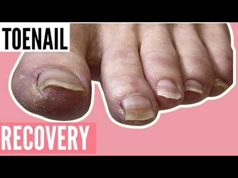 Toenail Recovery & Emotional Reset | Pedicure Transformation With Real-Life Wisdom