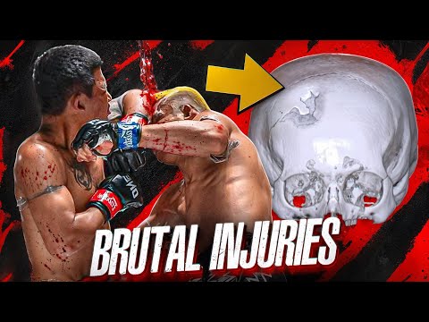 The most DISGUSTING MMA Video You’ll Ever Watch😳