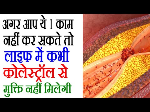 Cholesterol Kaise Kam Kare: आंवला खाने का ये तरीका कोलेस्ट्रॉल कम कर देगा, How To Reduce Cholesterol